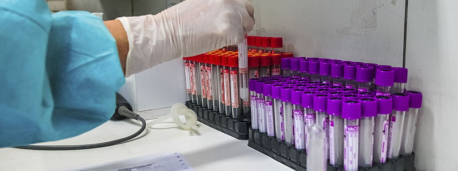 covid-19:-camara-aprova-projeto-que-incentiva-doacoes-para-pesquisas